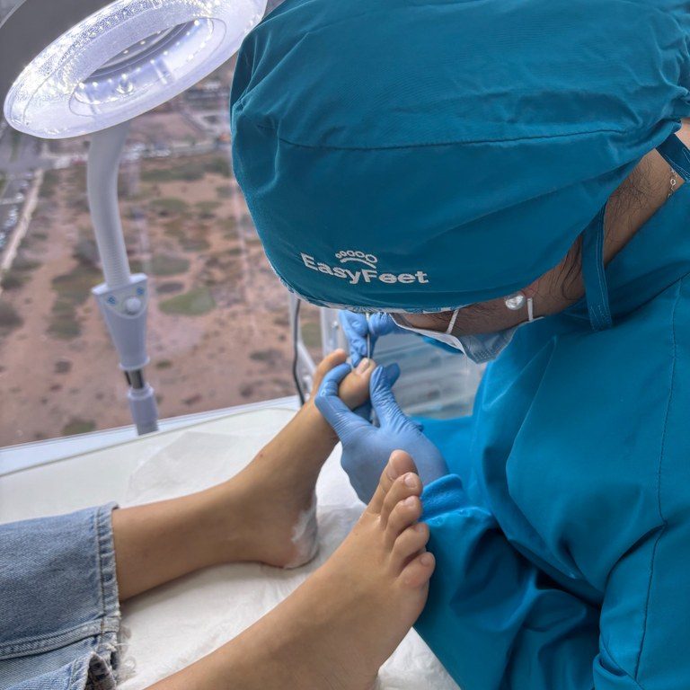 sesion-podologia-easyfeet-closeup-768x1024
