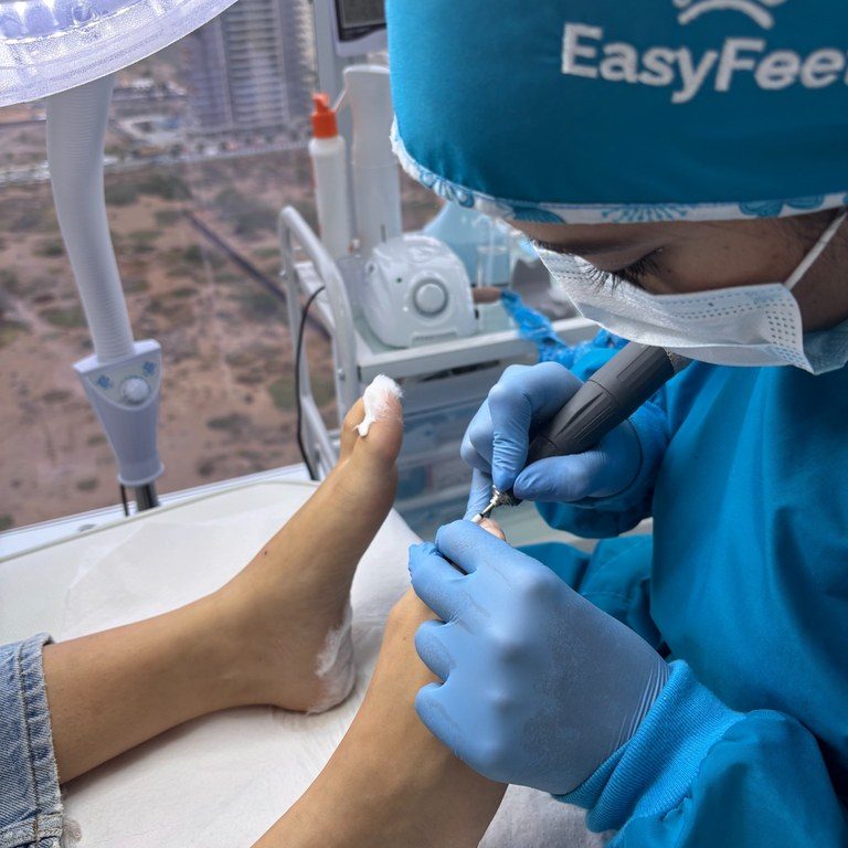 sesion-podologia-easyfeet-procedimiento-closeup-768x1024